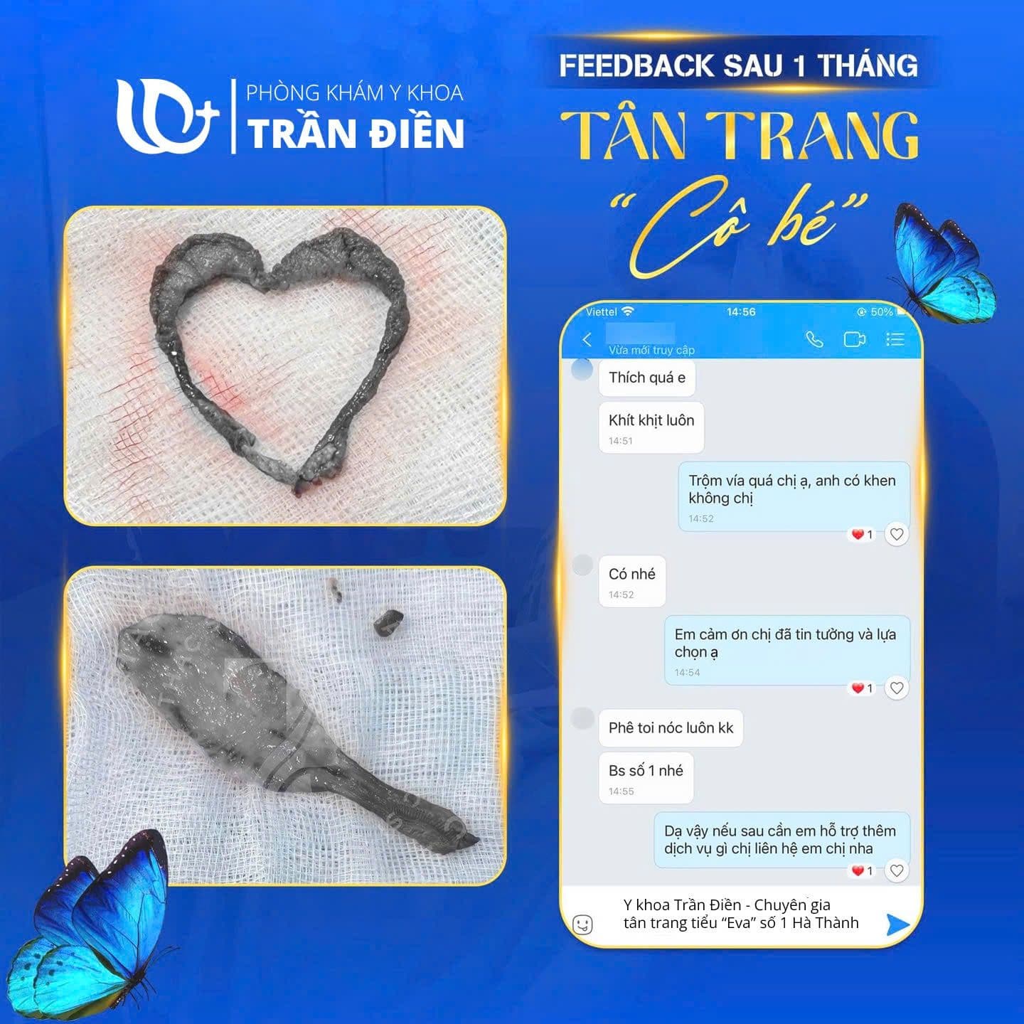 Chị H. Anh - 36 tuổi 